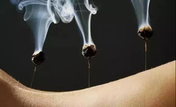 艾灸不是藥，調的不是病，央視為艾灸正名，讓我們正視艾灸