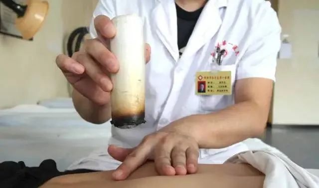 產(chǎn)后艾灸一個(gè)月，十年少生??！ 