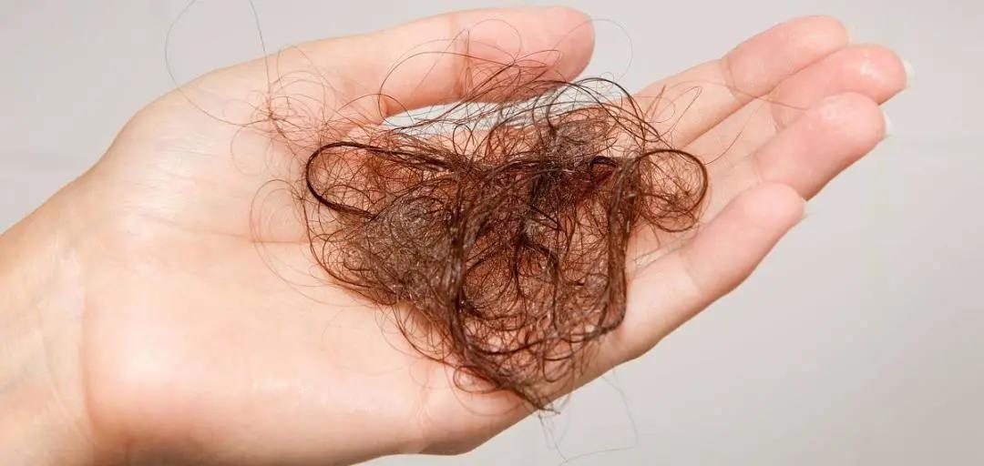 你脫的不是發(fā)，是氣血！艾灸拯救脫發(fā)危機！